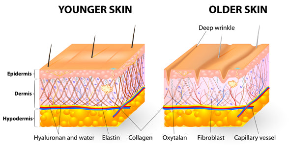 Radio Frequency Skin Tightening