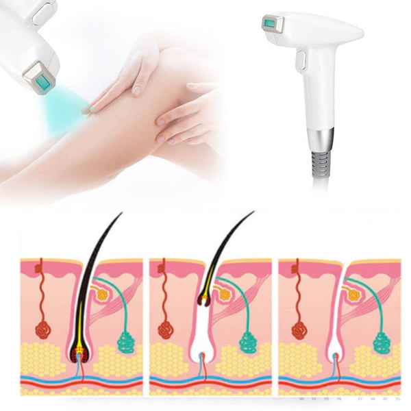 Diode Laser Hair Removal