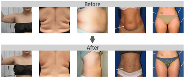 S Shape Machine Results