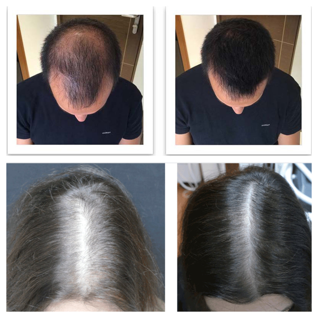 high frequency for hair growth